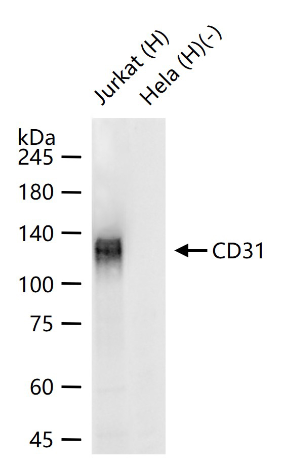 Mouse anti-CD31 Monoclonal Antibody