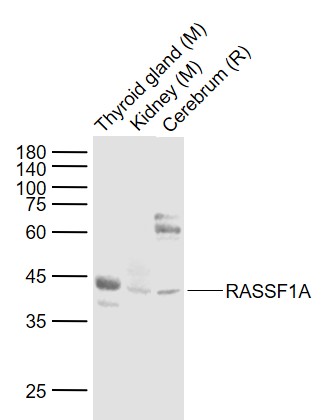 Rabbit anti-RASSF1A Polyclonal Antibody