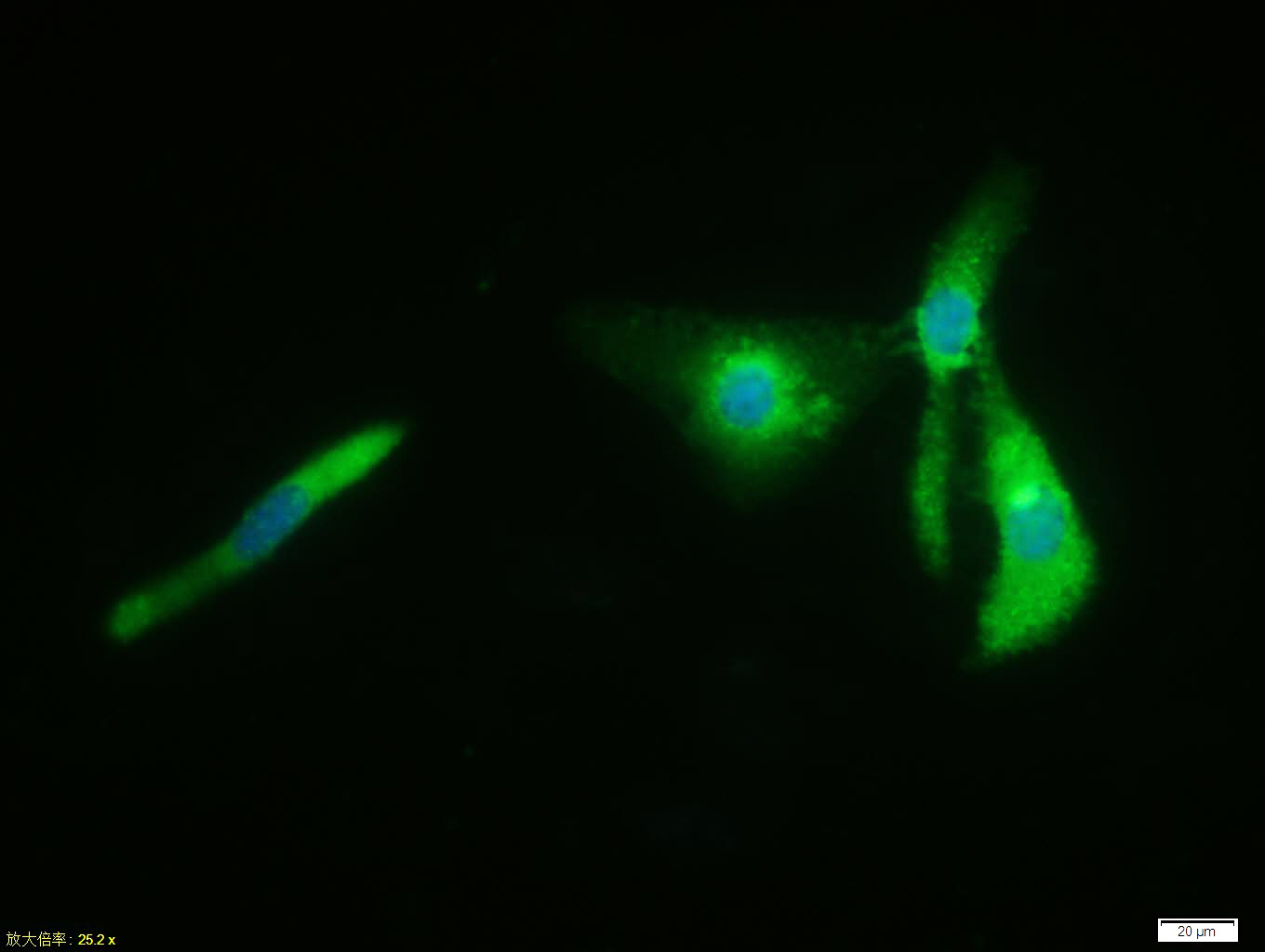 Rabbit anti-Phospho-β Catenin(Thr41+Ser45) Polyclonal Antibody