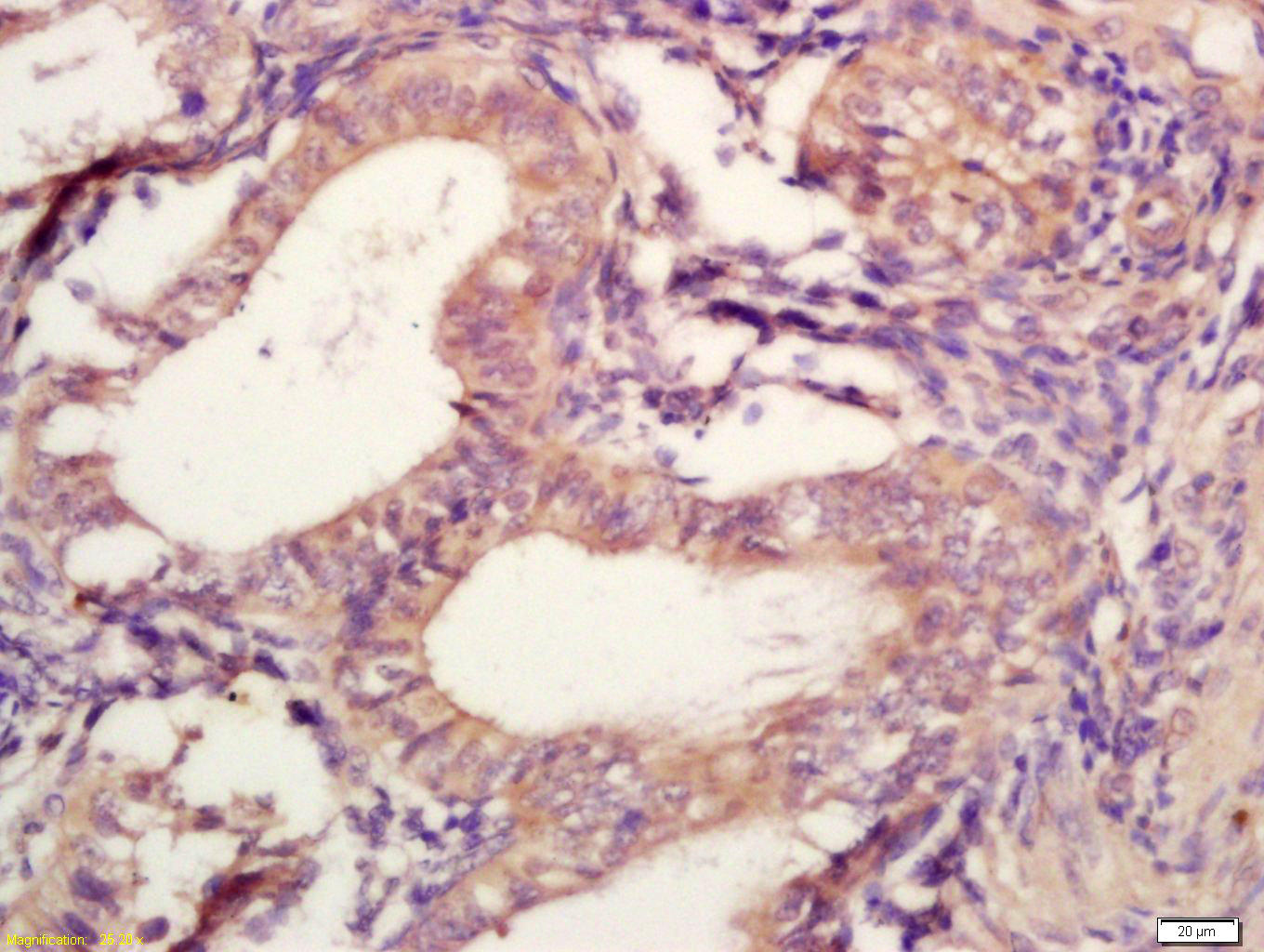 Rabbit anti-TIMP-2 Polyclonal Antibody