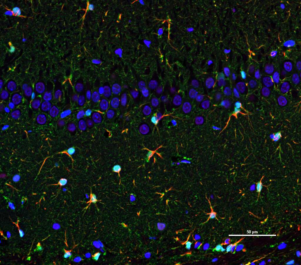 Mouse anti-S100B Monoclonal Antibody