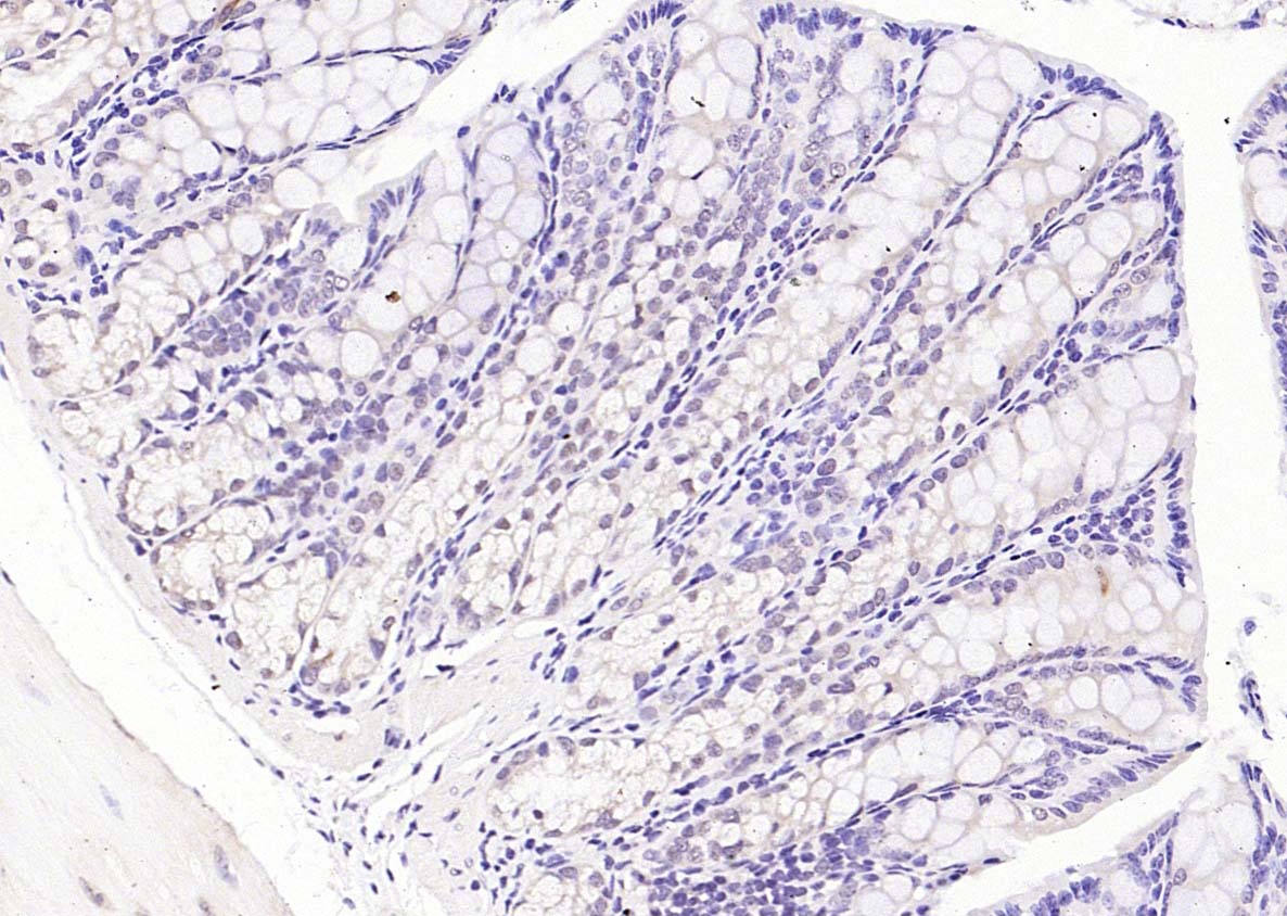 Rabbit anti-Phospho-PI3 Kinase p110 β(Ser1070) Polyclonal Antibody