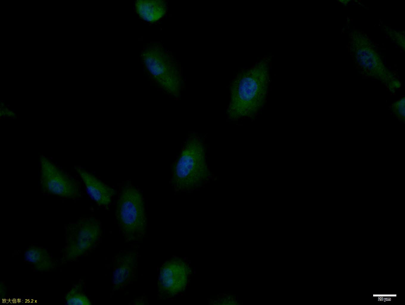 Rabbit anti-Phospho-IRS1(Ser636+Ser639) Polyclonal Antibody