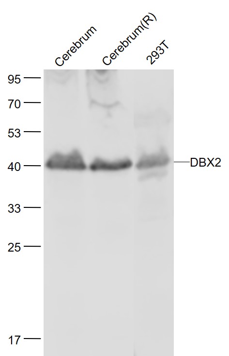 Rabbit anti-DBX2 Polyclonal Antibody