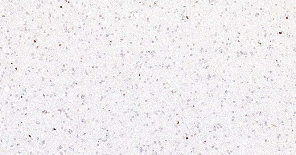 Rabbit anti-PCNA(Nuclear Loading Control) Monoclonal Antibody