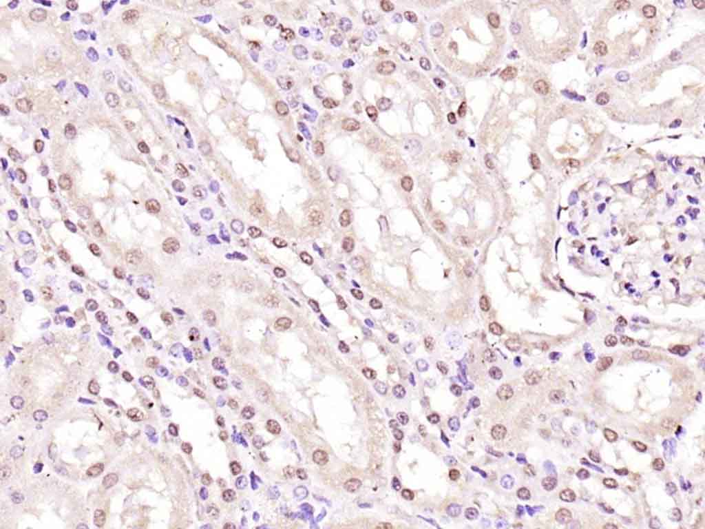 Rabbit anti-Phospho-Histone H1.4(Thr18) Polyclonal Antibody