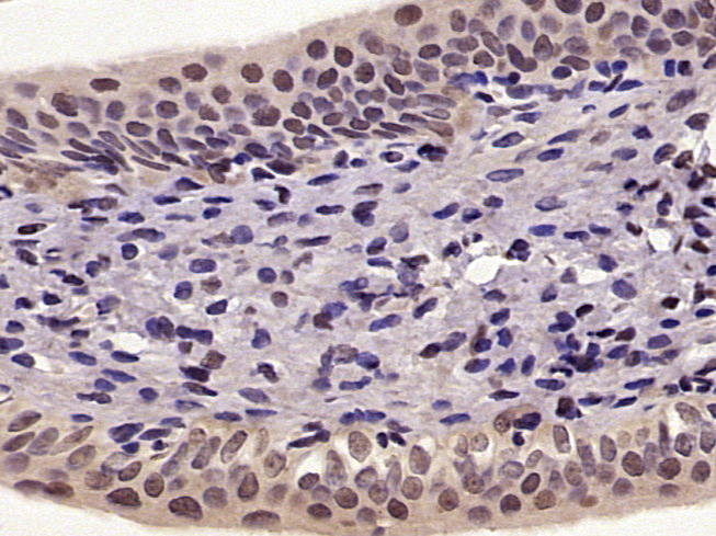 Rabbit anti-Phospho-NFKB p65(Ser276) Polyclonal Antibody