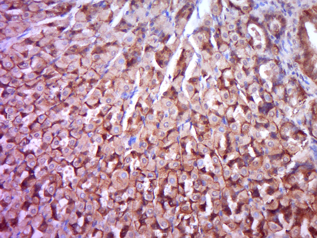 Rabbit anti-Phospho-PKC δ(Ser645) Polyclonal Antibody