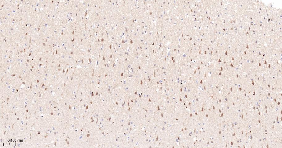 Rabbit anti-PKC δ Monoclonal Antibody