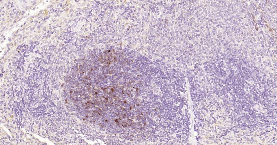 Mouse anti-S100B Monoclonal Antibody
