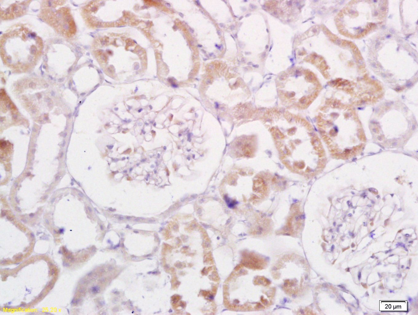 Rabbit Anti-TRADD Polyclonal Antibody