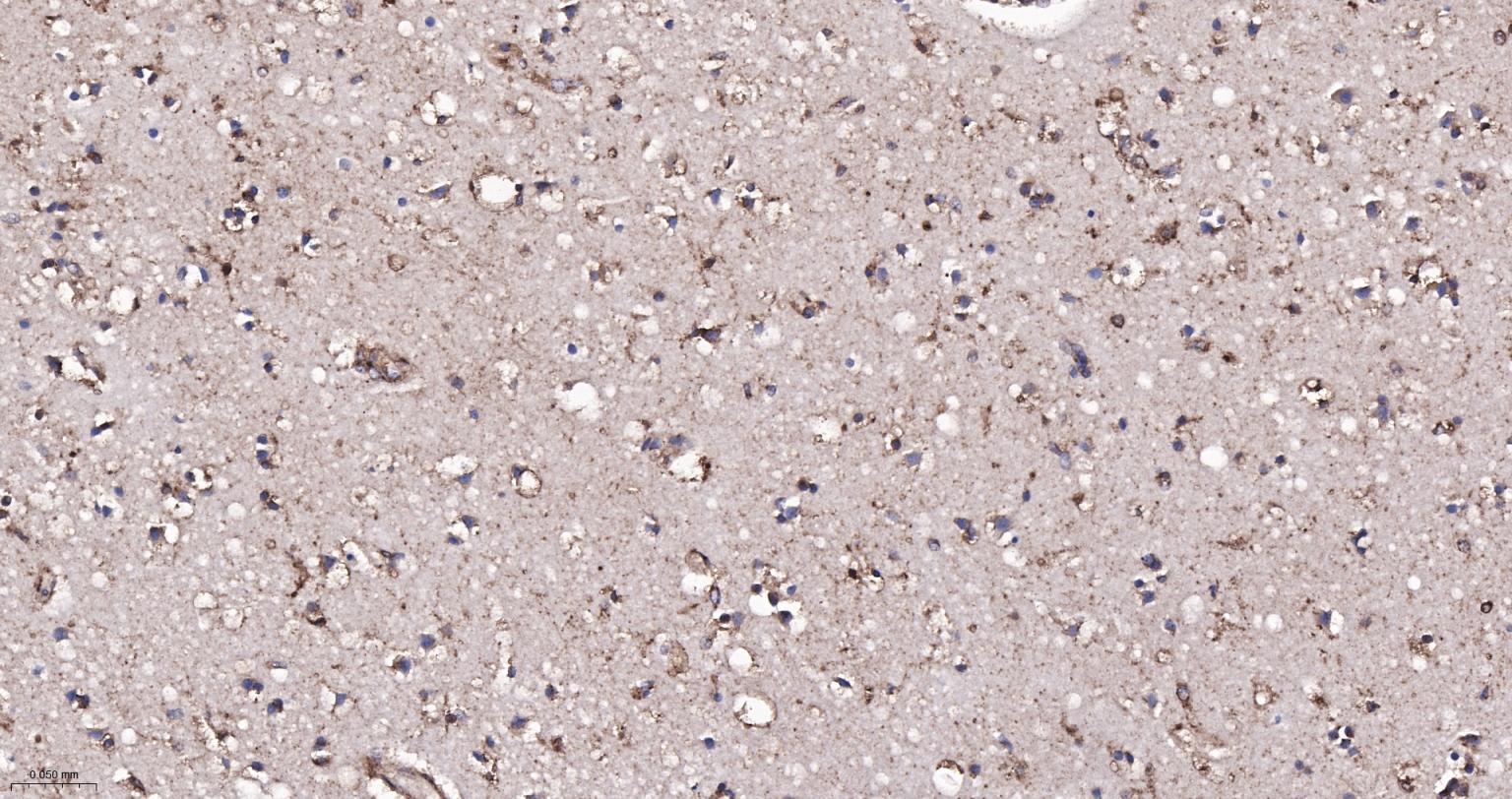 Rabbit anti- BDNF Monoclonal Antibody