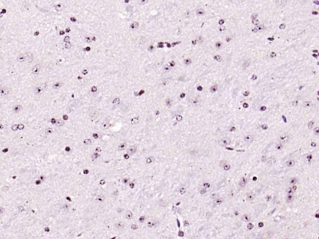 Rabbit anti-Phospho-FAK(Tyr576+Tyr577) Polyclonal Antibody