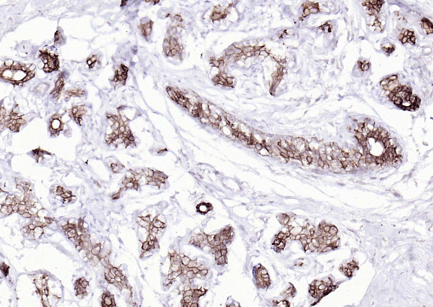 Mouse anti-Cytokeratin 8 Monoclonal Antibody