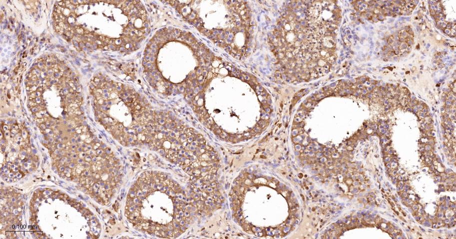 Rabbit anti-LDHA Polyclonal Antibody