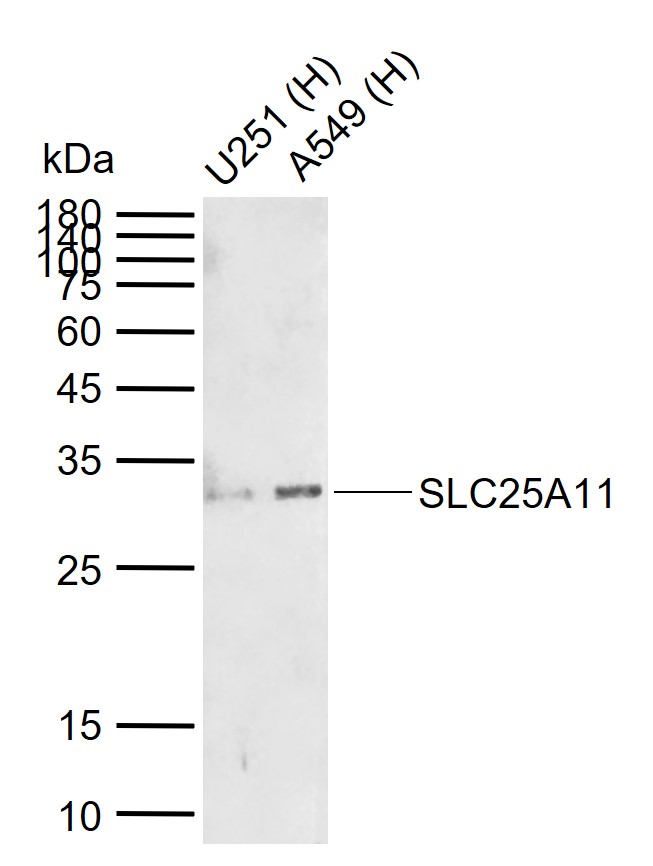 Rabbit anti-SLC25A11 Polyclonal Antibody