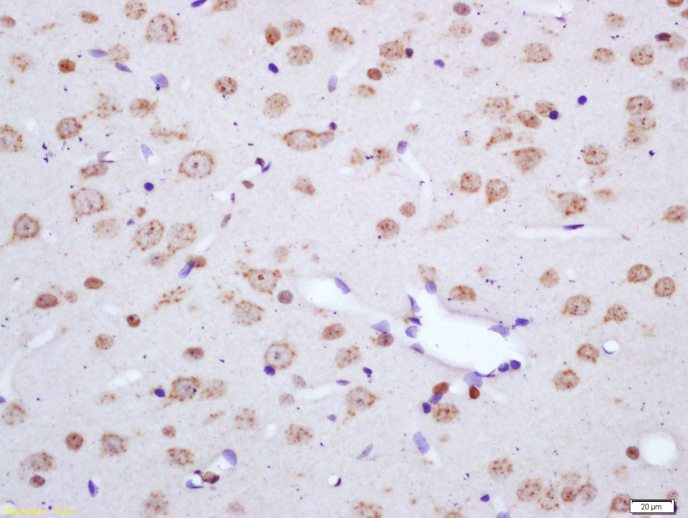 Rabbit anti-NF2 Polyclonal Antibody