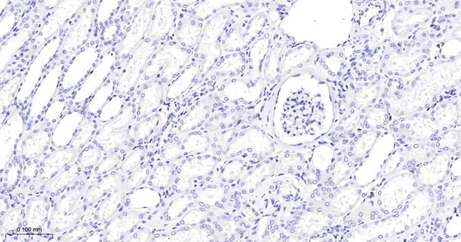 Rabbit anti-RAGE Monoclonal Antibody