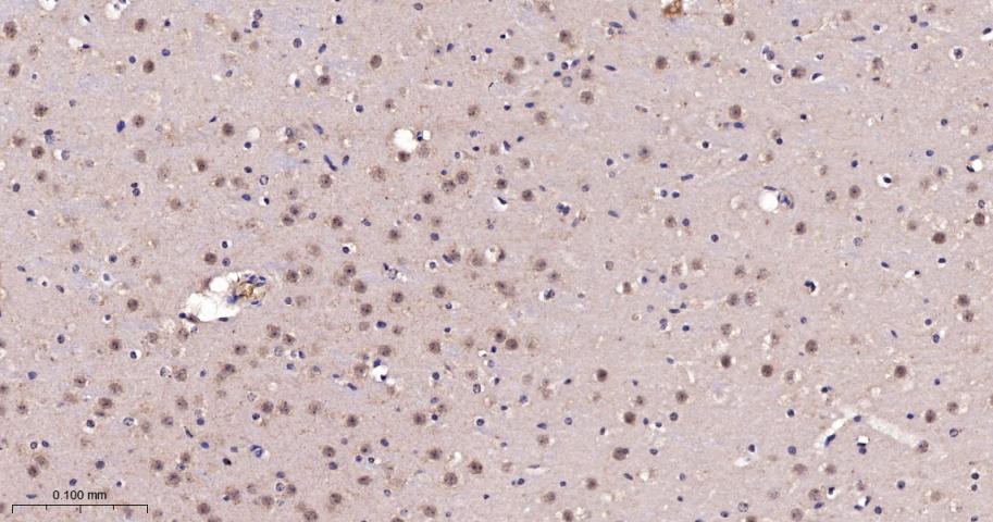 Rabbit anti-TSG101 Monoclonal Antibody