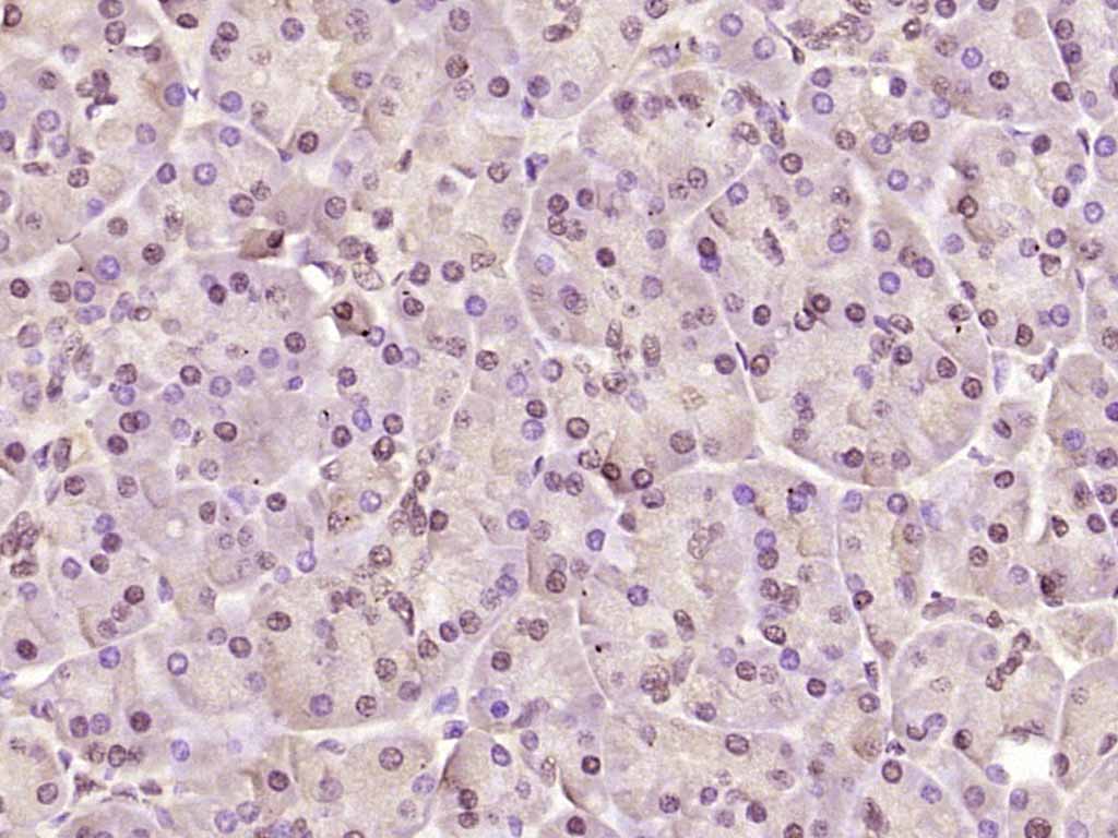 Rabbit anti-Phospho-AMPKα-1(Thr183) Polyclonal Antibody