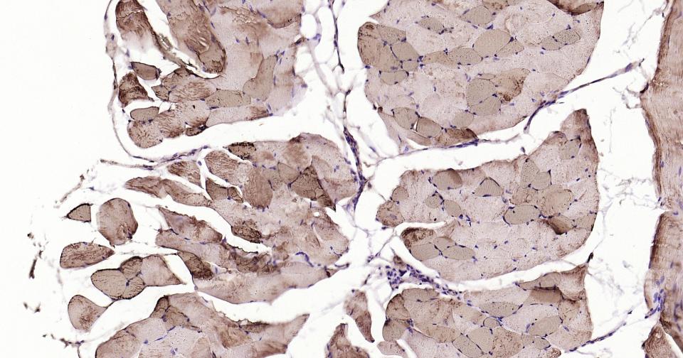 Rabbit anti-Myoglobin Polyclonal Antibody