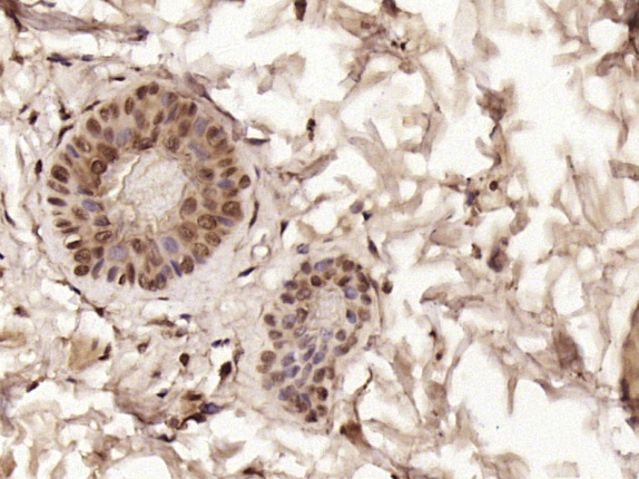 Rabbit anti-Phospho-CK18(Ser52) Polyclonal Antibody
