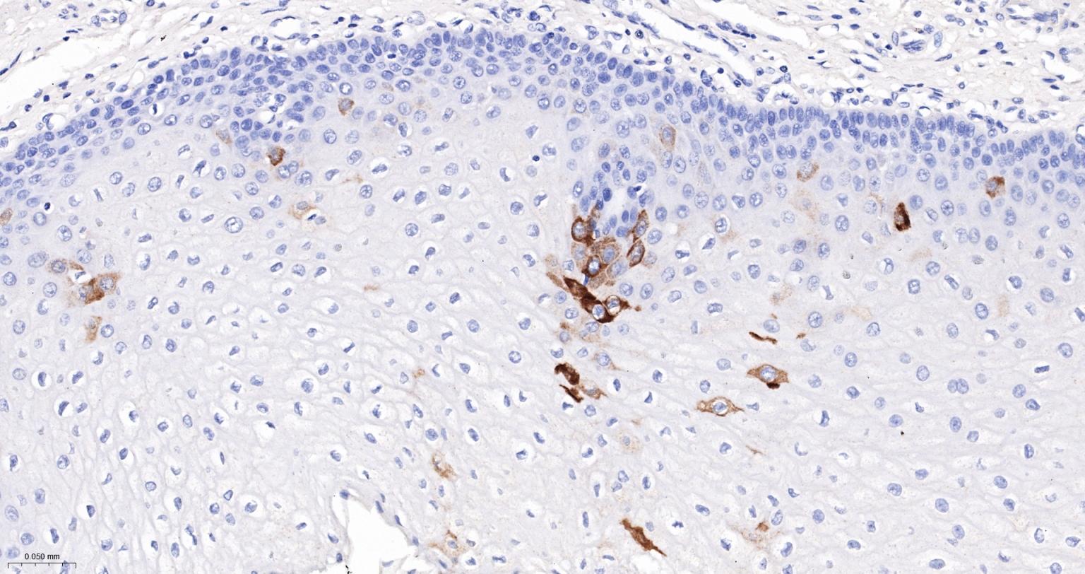 Rabbit anti-CK10/Cytokeratin 10 Monoclonal Antibody