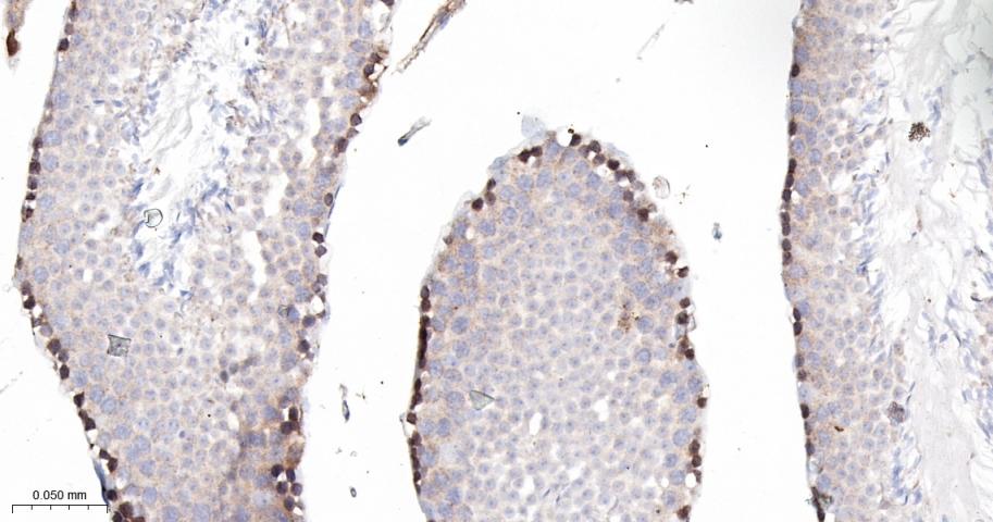 Rabbit anti-PKC δ Monoclonal Antibody
