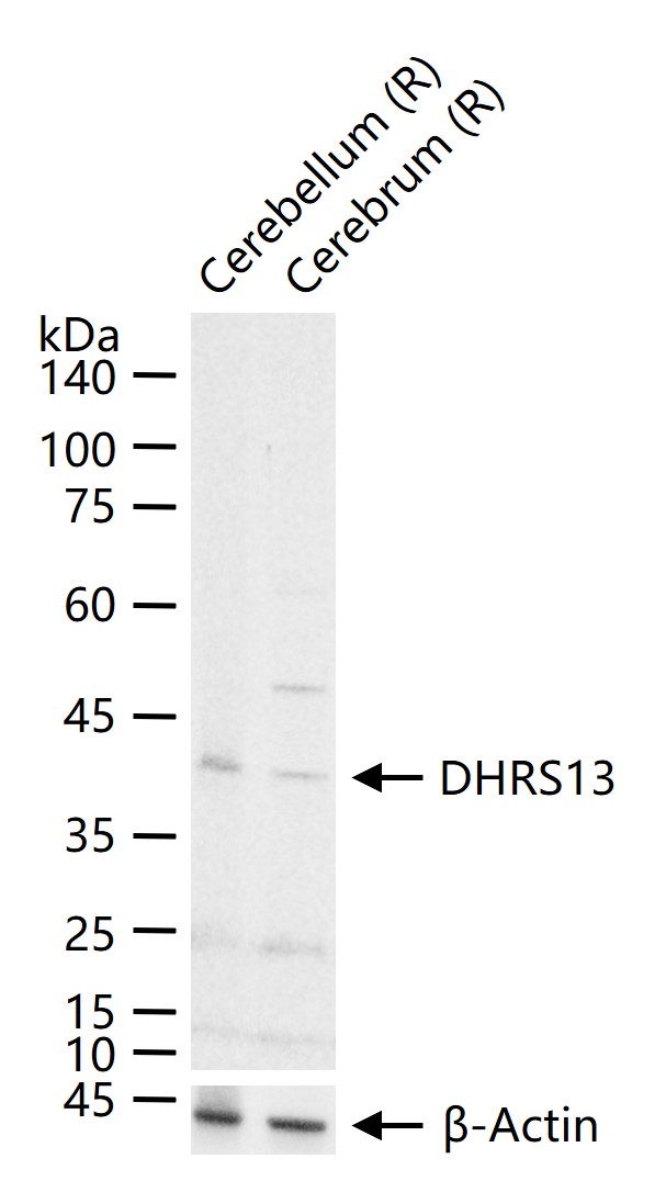 Rabbit Anti-DHRS13 Polyclonal Antibody
