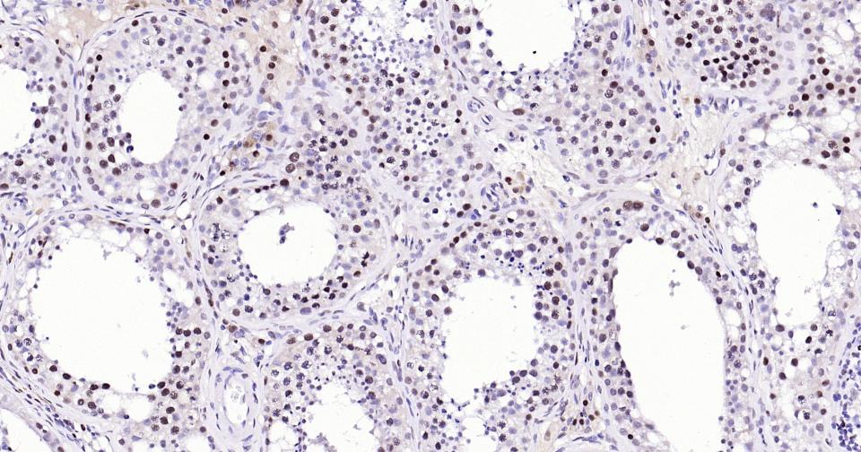 Rabbit anti-PCNA(Nuclear Loading Control) Monoclonal Antibody