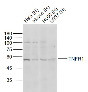 Rabbit anti-TNFR1 Polyclonal Antibody
