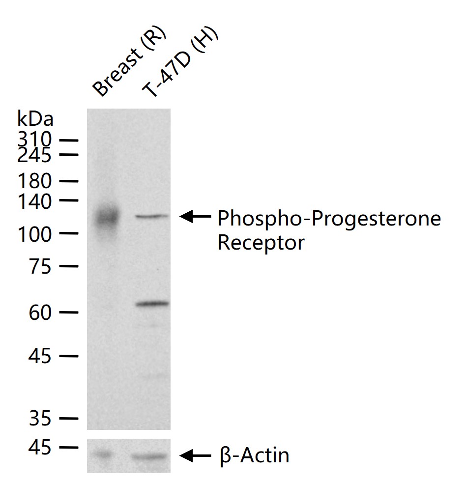 Rabbit anti-Phospho-Progesterone Receptor(Ser190) Polyclonal Antibody