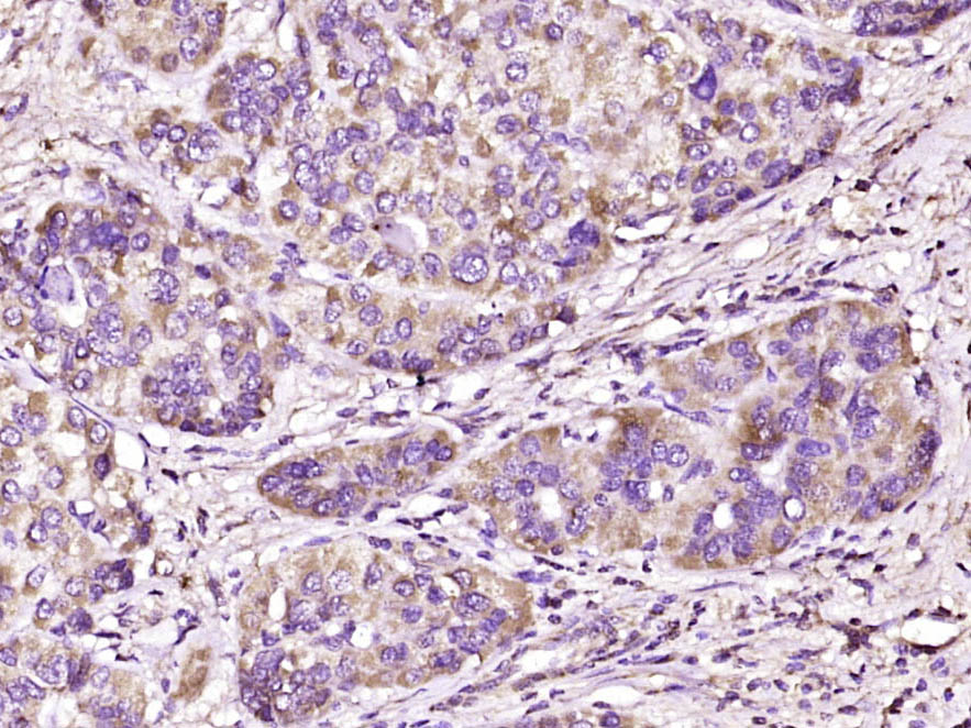Rabbit Anti-SEMA4A Polyclonal Antibody