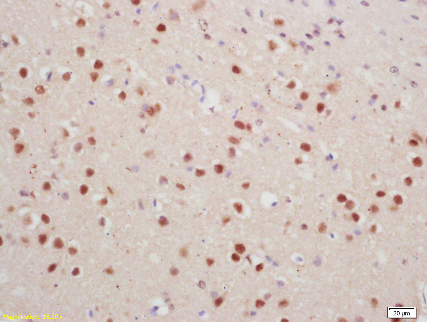 Rabbit anti-Phospho-Histone H1.4(Thr18) Polyclonal Antibody