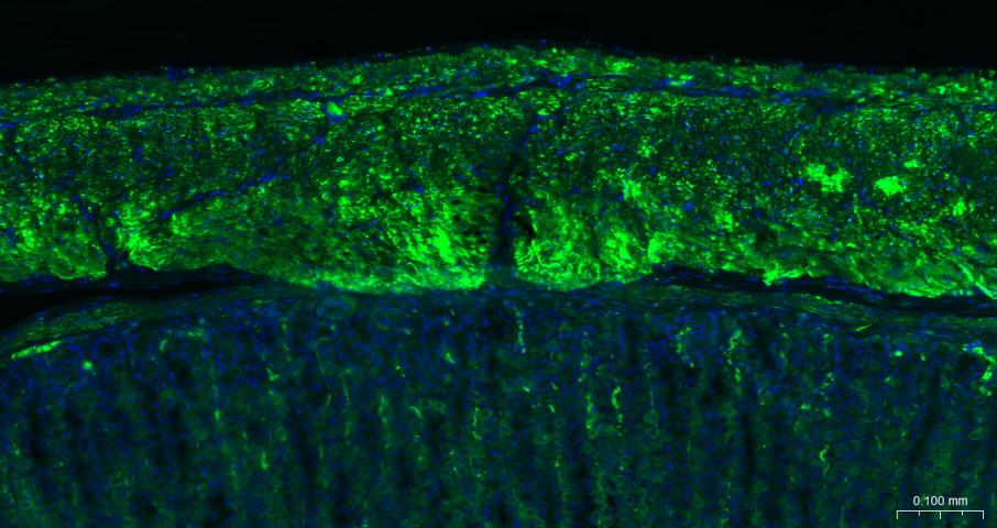 Rabbit anti-α Smooth Muscle Actin Monoclonal Antibody