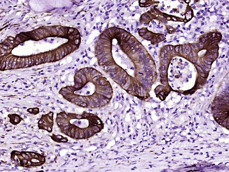 Mouse anti-Cytokeratin 8 Monoclonal Antibody