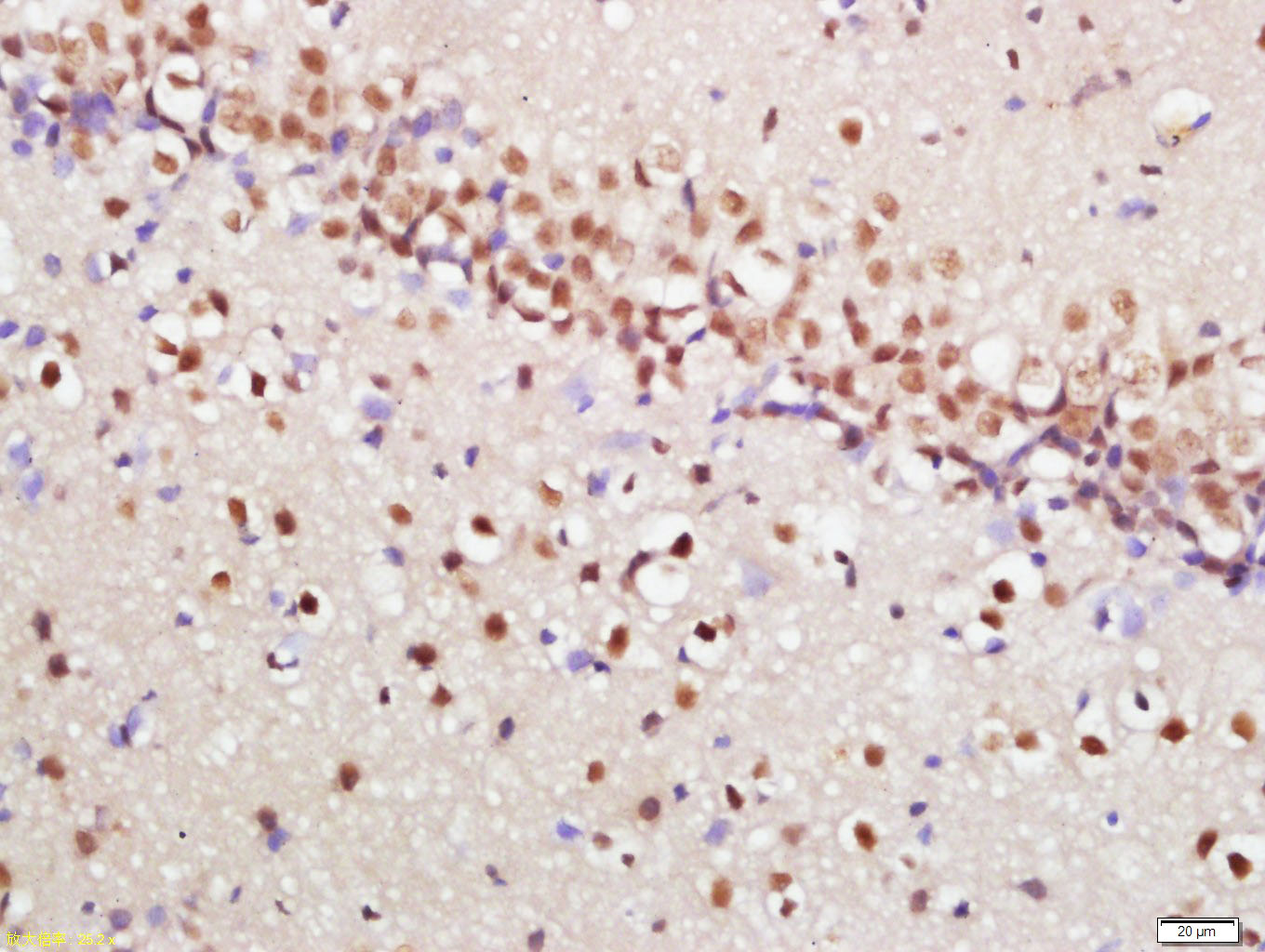 Rabbit anti-Phospho-mTOR(Ser2448) Polyclonal Antibody