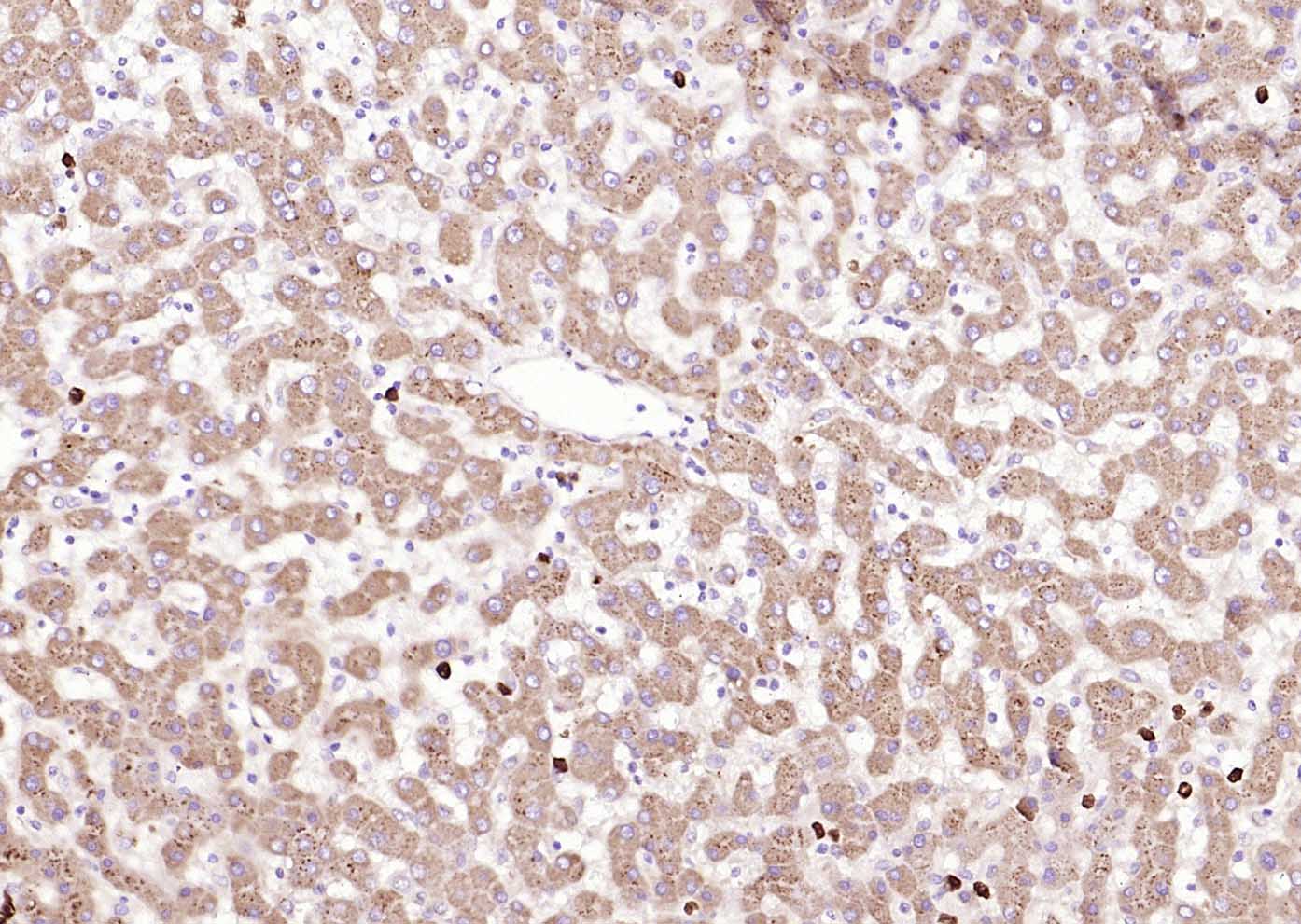 Rabbit Anti-MARCH6 Polyclonal Antibody