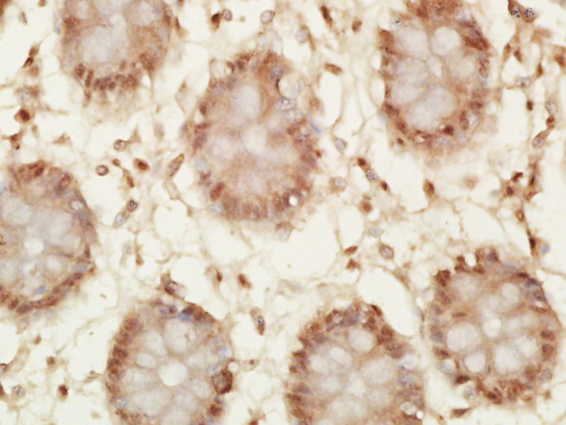 Rabbit anti-Phospho-P53(Thr55) Polyclonal Antibody