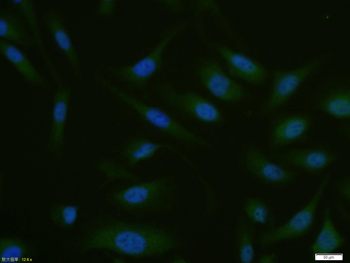Rabbit anti-MADH7 Polyclonal Antibody
