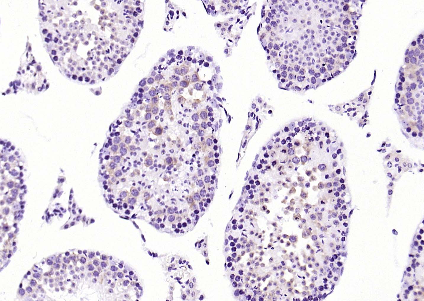 Rabbit anti-MetAP1 Polyclonal Antibody