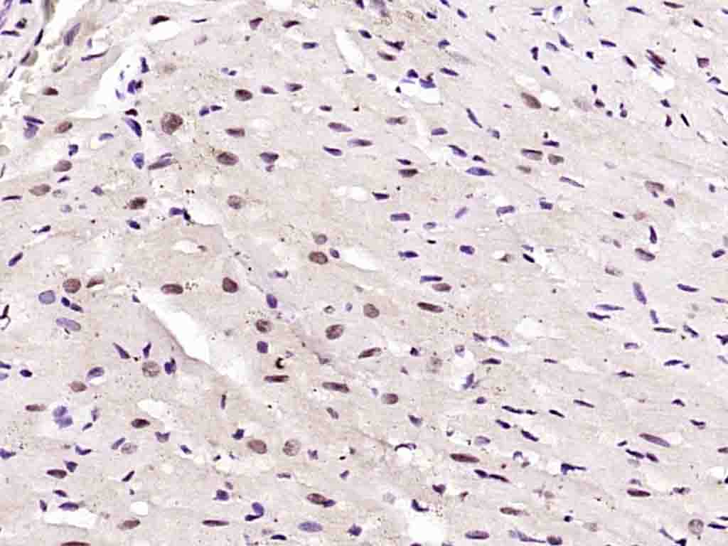Rabbit anti-Phospho-AMPKα-1(Thr183) Polyclonal Antibody