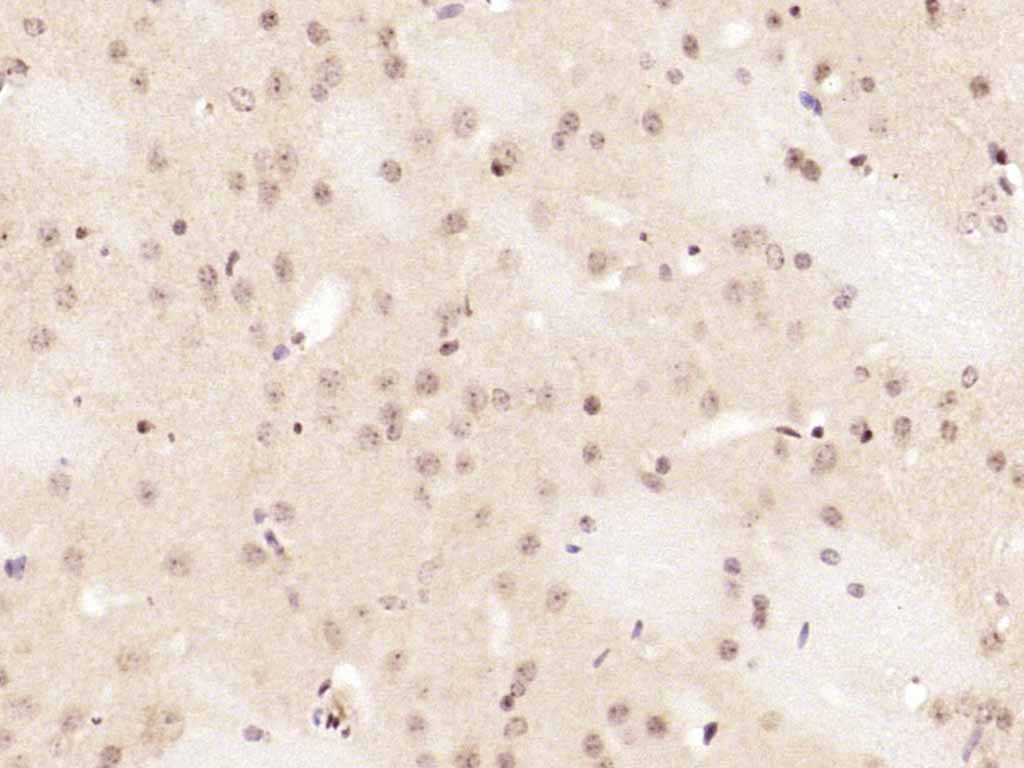 Rabbit anti-Phospho-NFKB1(Ser337) Polyclonal Antibody