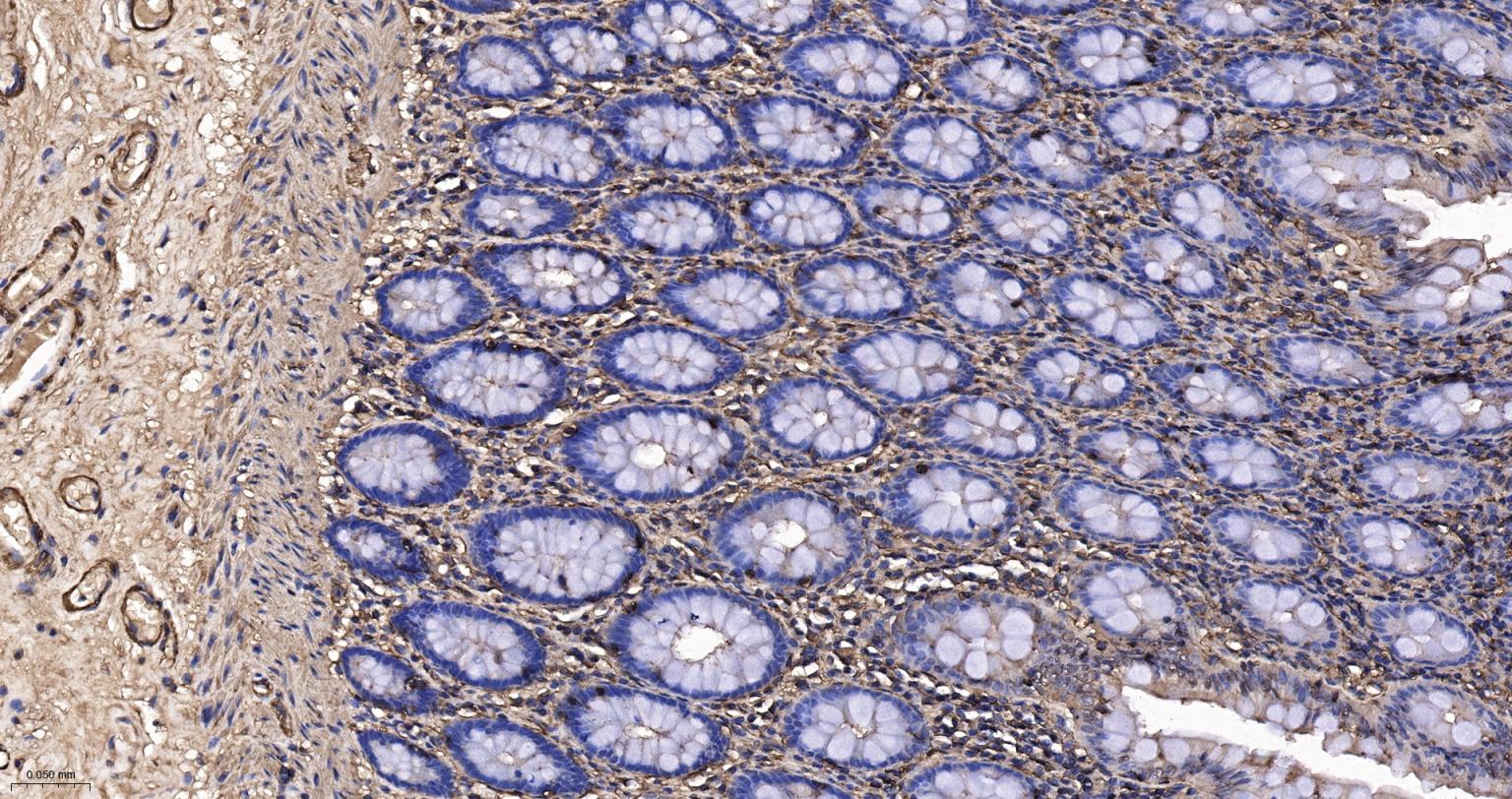 Rabbit anti-α Smooth Muscle Actin Polyclonal Antibody