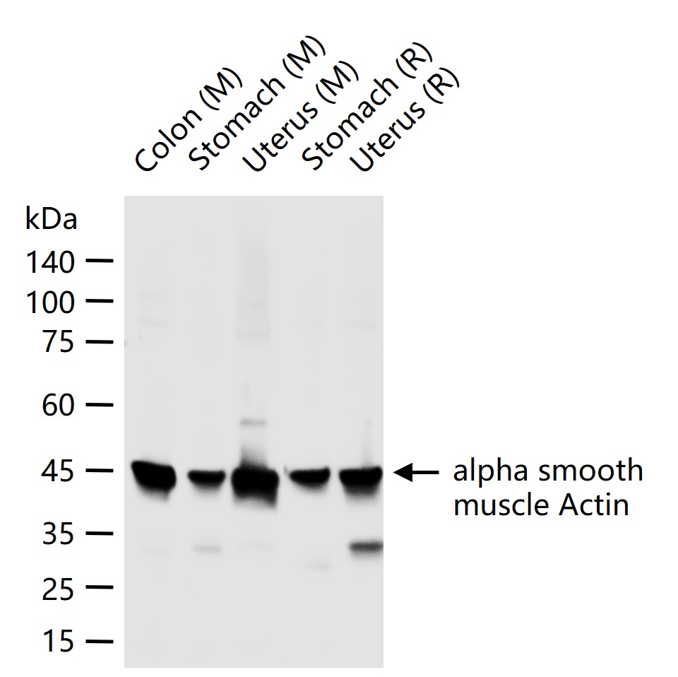Rabbit anti-α Smooth Muscle Actin Monoclonal Antibody