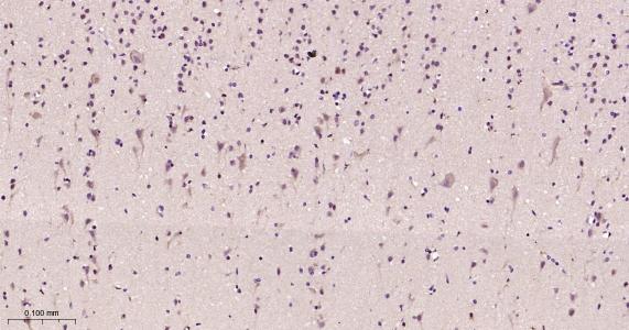 Rabbit anti-NGF Monoclonal Antibody