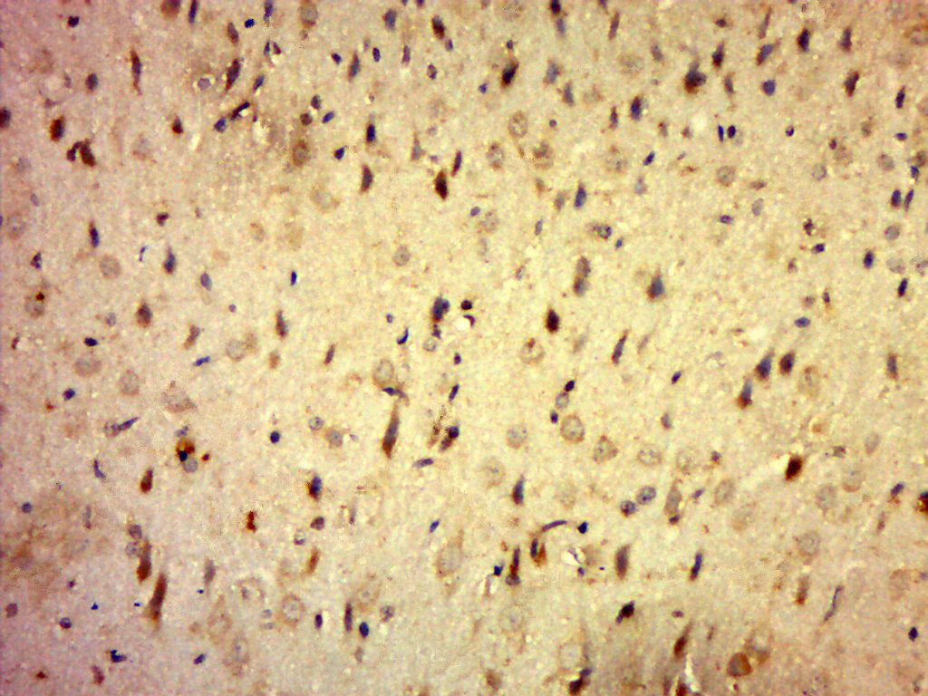 Rabbit Anti-C20orf196 Polyclonal Antibody