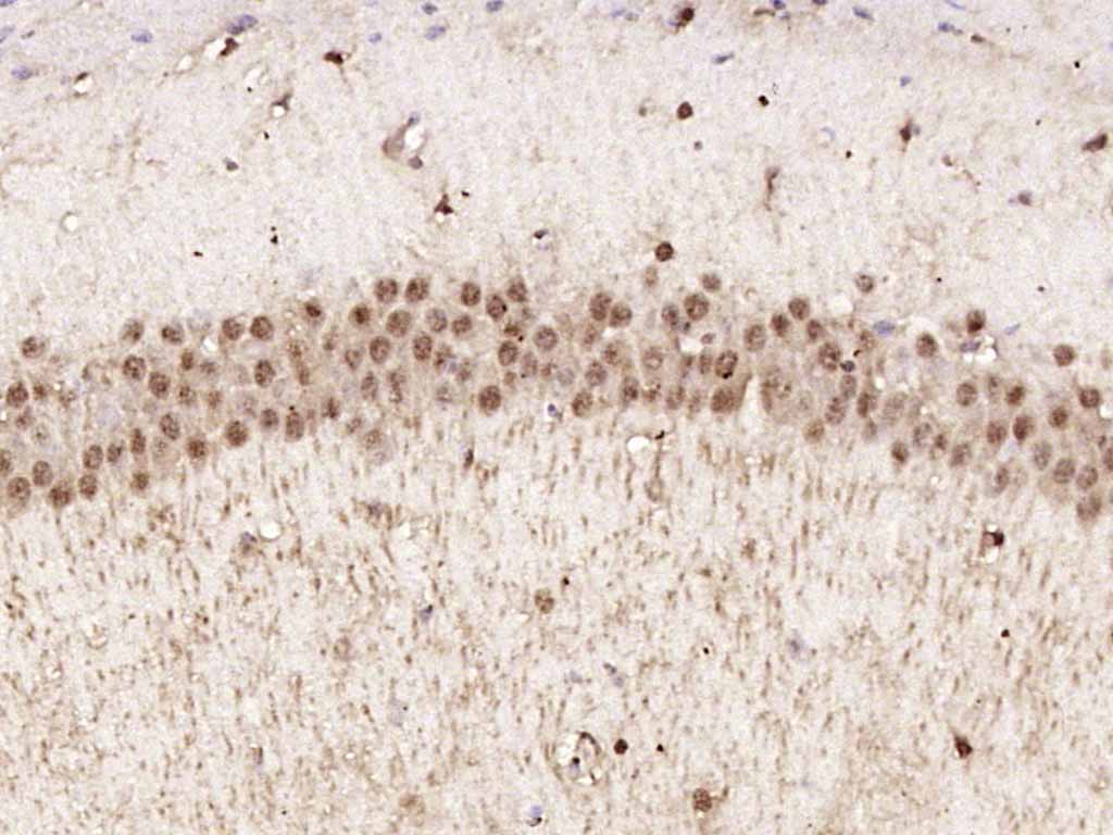 Rabbit anti-Phospho-AMPKα-1(Thr183) Polyclonal Antibody