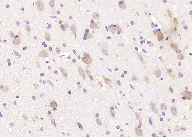 Rabbit anti-CHIP Polyclonal Antibody