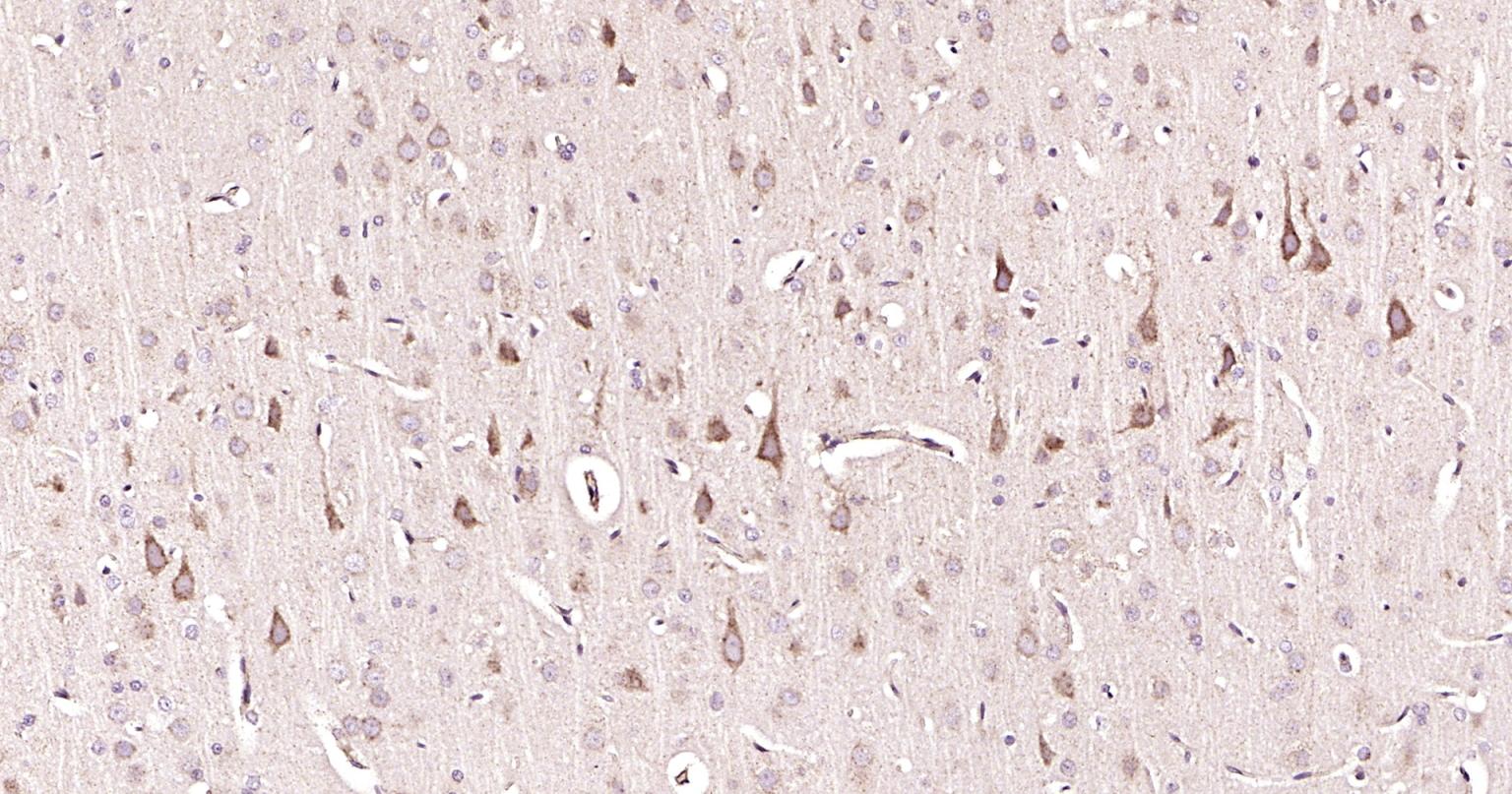 Rabbit anti-Beclin 1 Polyclonal Antibody